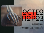 Остеопороз – болезнь пожилых людей?